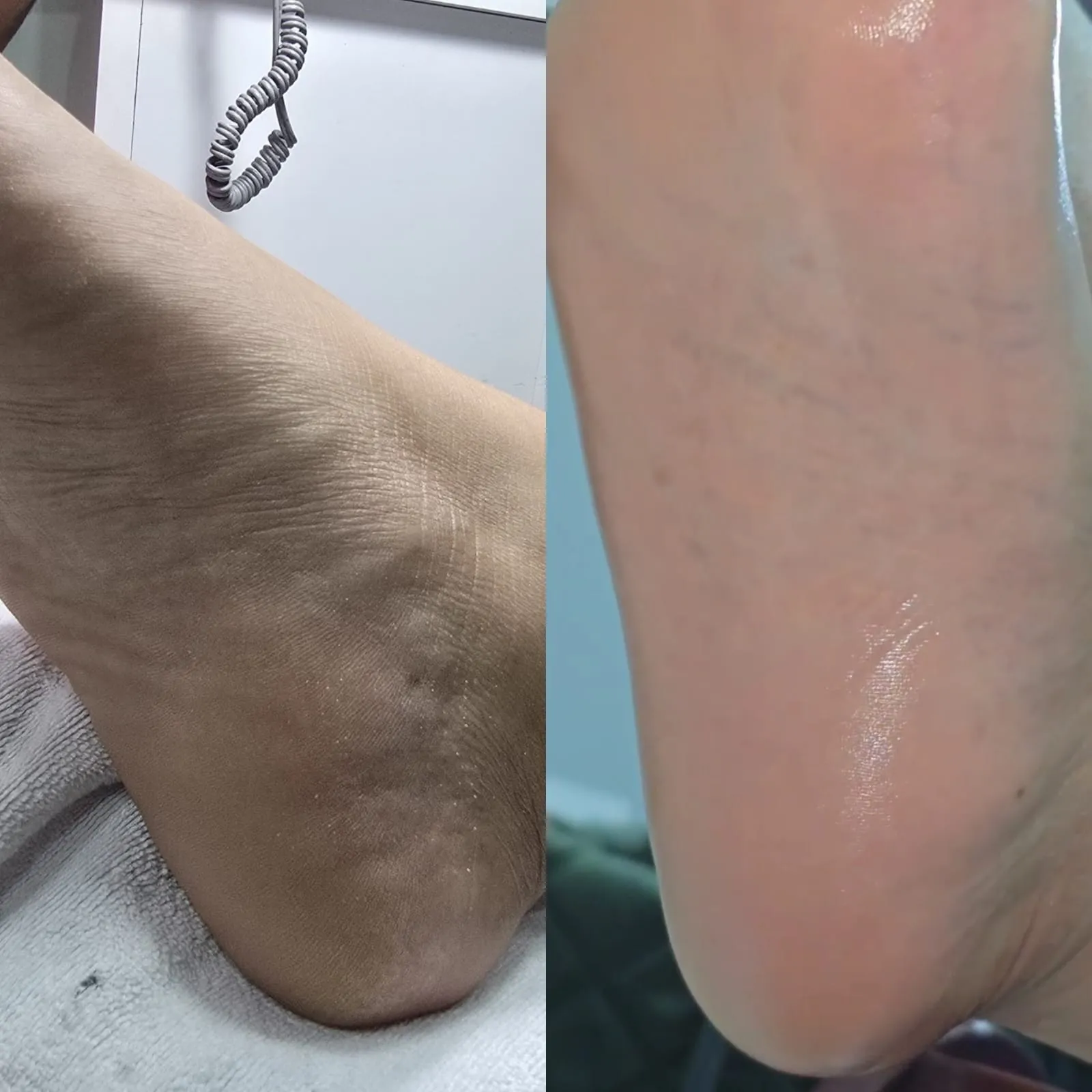 Pedicure 4 - Mi Vida Salón